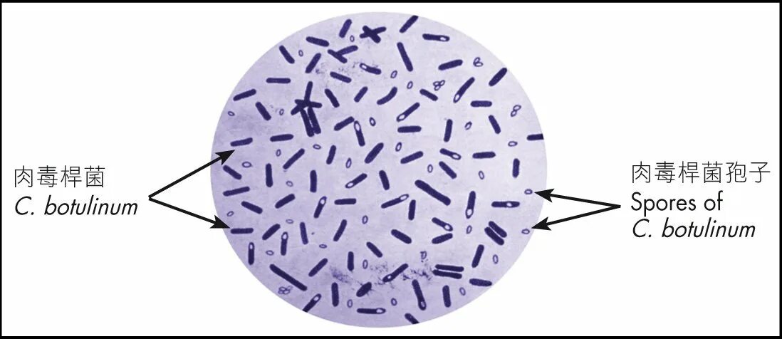 Clostridium spp. Клостридиум перфрингенс морфология. Морфология клостридии перфрингенс. Бактерии клостридиум. Клостридии перфрингенс микроскоп.