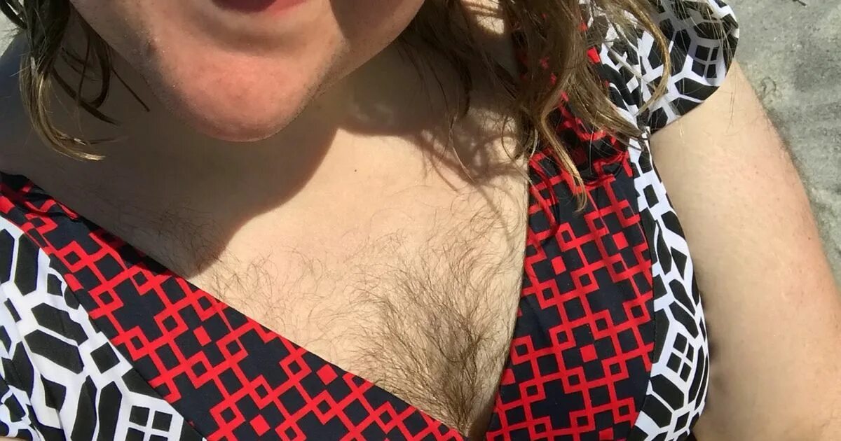 Ланугинозный гипертрихоз. Волосатая подмышка девушки. Волосвтая женская гудь. У девушек растут волосы на сосках. Джулия робертс небритые подмышки.