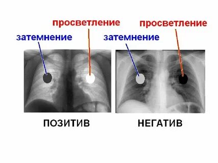 Что такое затемнение