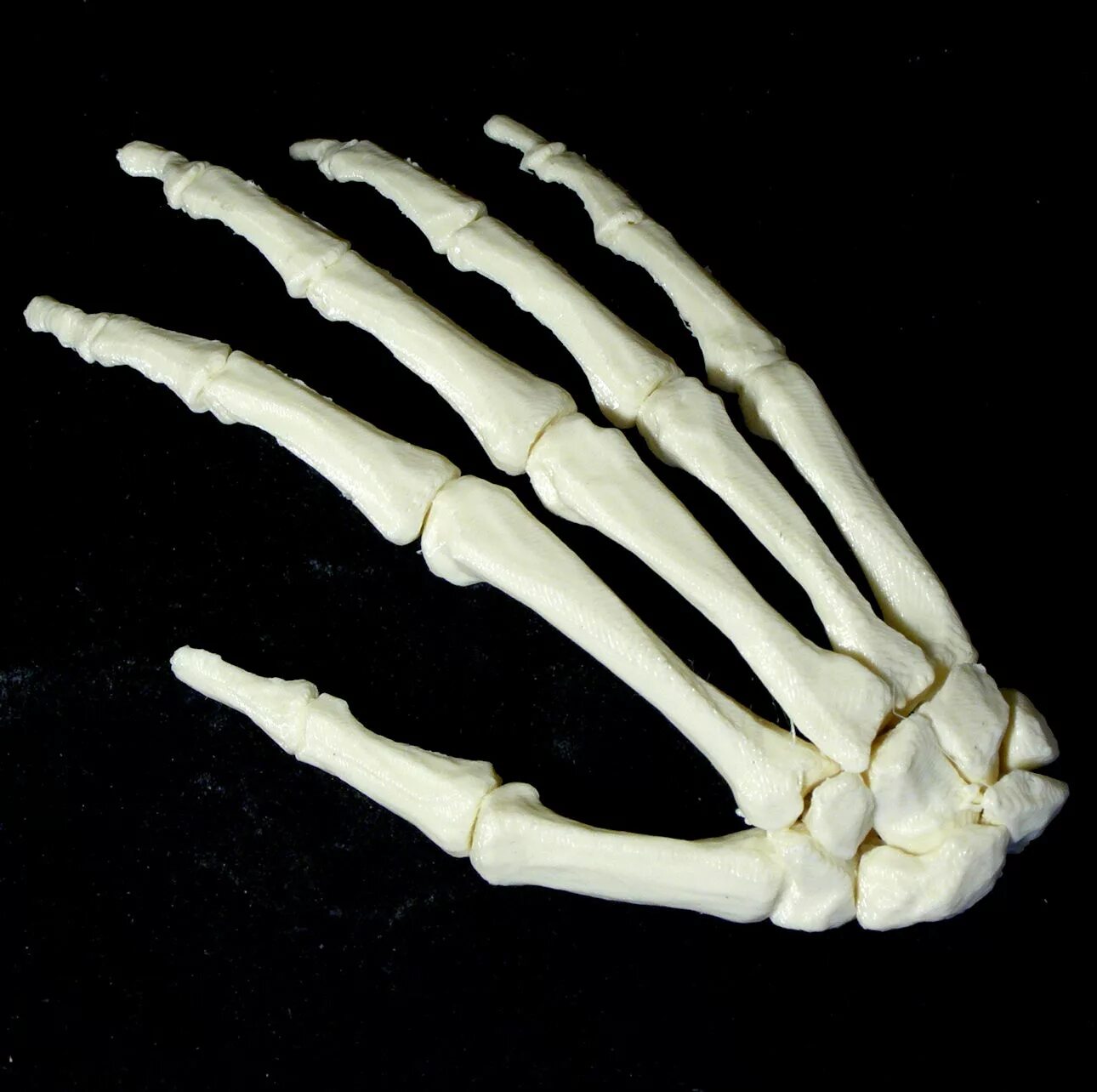 Кости metacarpi. Кости кисти (ossa Manus) anomaliya. Skeleton hand 3d. Hand Bones. Hand bone