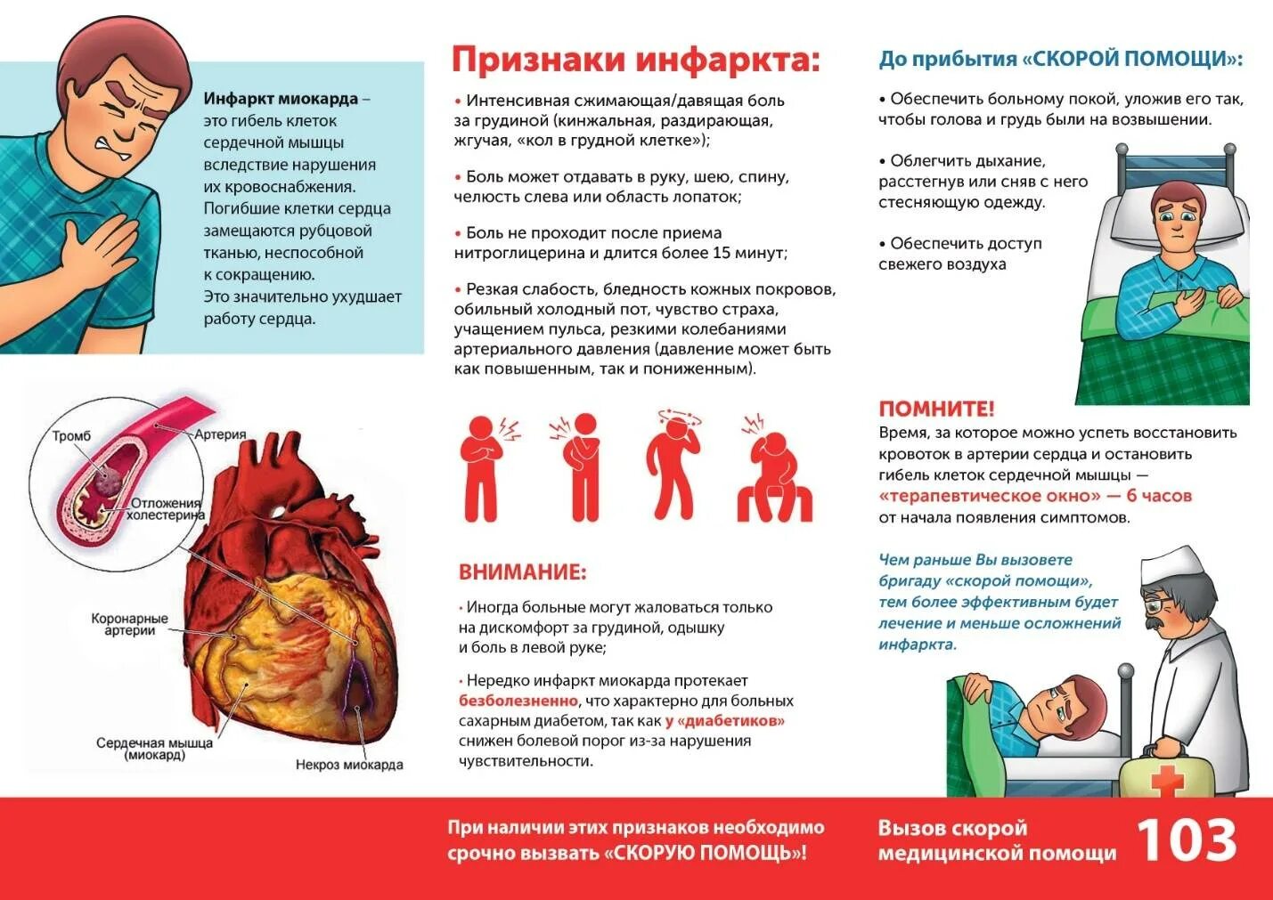 Алгоритм оказания помощи при инфаркте. Профилактика инфаркта миокарда памятка. Профилактика острого инфаркта миокарда памятка. Санбюллетень профилактика инфаркта миокарда. Профилактика инфаркта миокарда буклет.