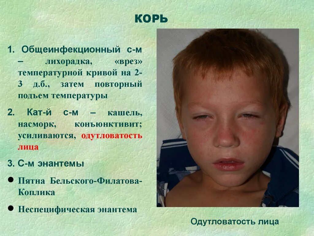 Какое лечение при кори. Какое лечение при кори