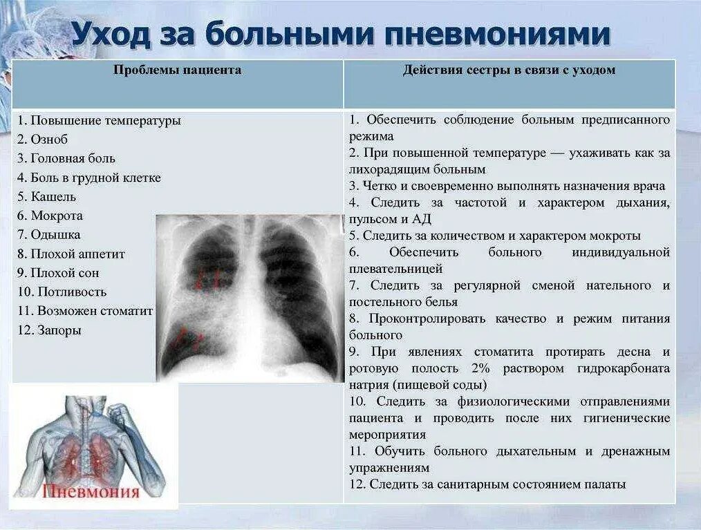 Сколько лежат с пневмонией в больнице взрослые. Острая очаговая пневмония симптомы. Начальные симптомы пневмонии.