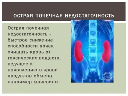Почечная недостаточность первая помощь