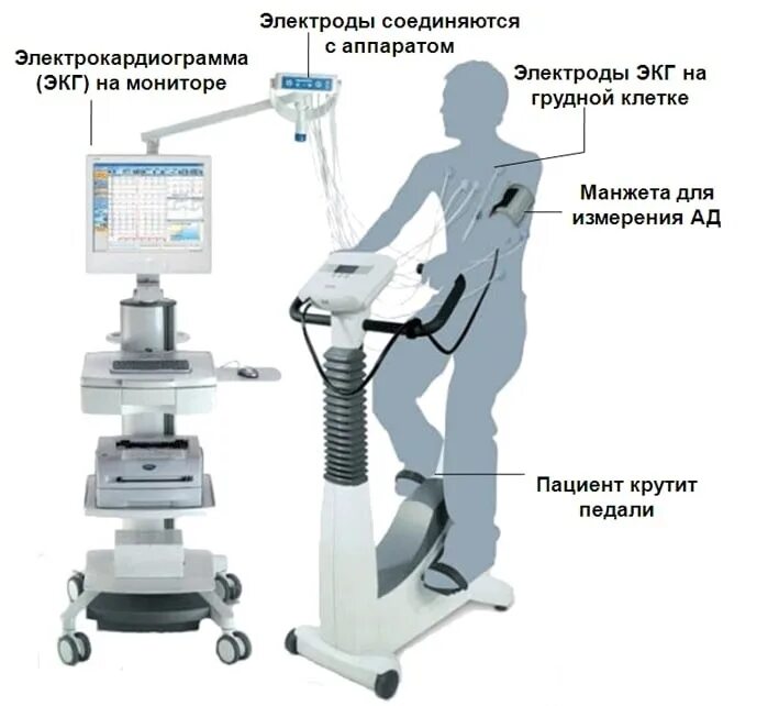 Аппарат ВЭМ велоэргометрия. Нагрузочная проба ВЭМ. Нагрузочные пробы (тредмил-тест, ВЭМ). Нагрузочные тесты (тредмил, велоэргометрия). Нагрузочное экг