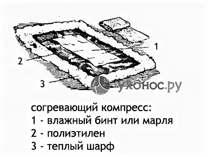 Техника наложения компресса. Согревающий компресс. Спиртовой компресс. Схема постановки согревающего компресса. Слой согревающего компресса на ухо.