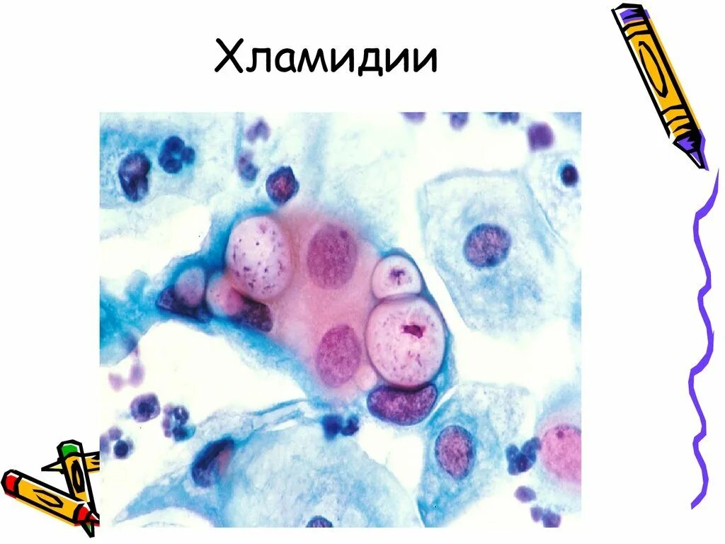 Хламидии chlamydia trachomatis. Хламидии морфология микробиология. микробиология хламидии трахоматис. хламидия трахоматис морфология. хламидии романовскому гимзе.