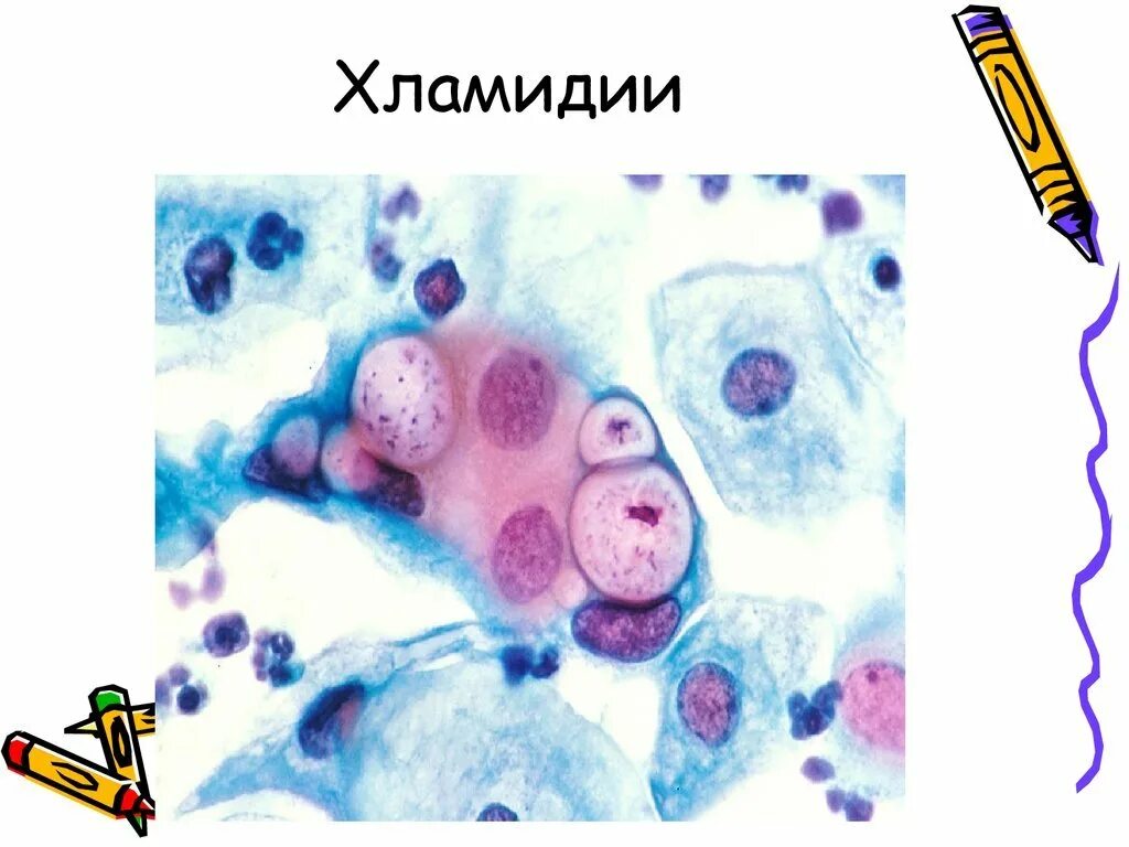 Хламидия chlamydia. Хламидии морфология микробиология. Хламидия трахоматис морфология. Хламидии Романовскому Гимзе. Chlamydia trachomatis микробиология.