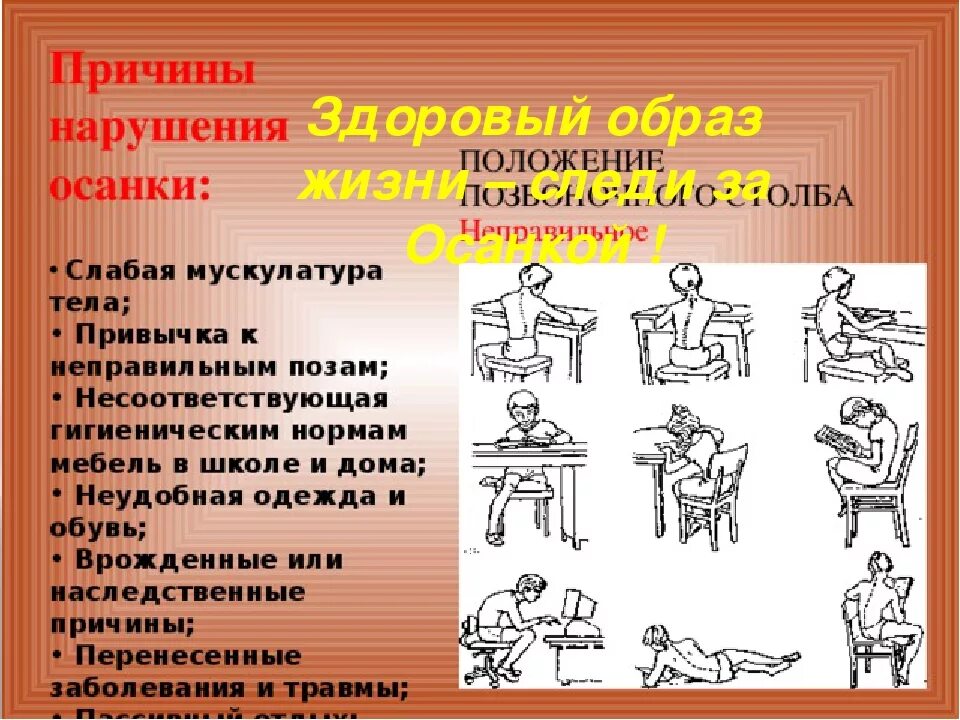 Нарушения часто приводят к. Причины нарушения осанки. Причины нарушенной осанки. Причины формирования нарушений осанки. Факторы приводящие к нарушению осанки.