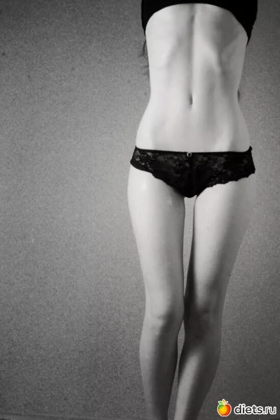 Thigh gap. Худое тело. Очень худое тело девушки. Костлявое тело девушки.
