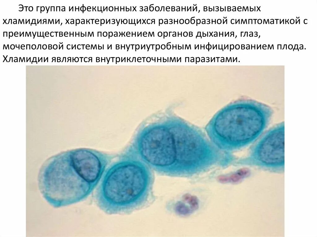 Урогенитальный хламидиоз возбудитель. Хламидии заболевания у человека. Хламидии - возбудители урогенитальных инфекций. Откуда хламидиоз