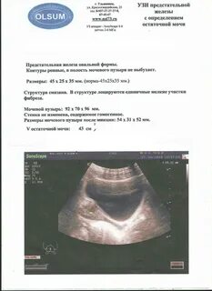 Узи мочевого пузыря с определением остаточной