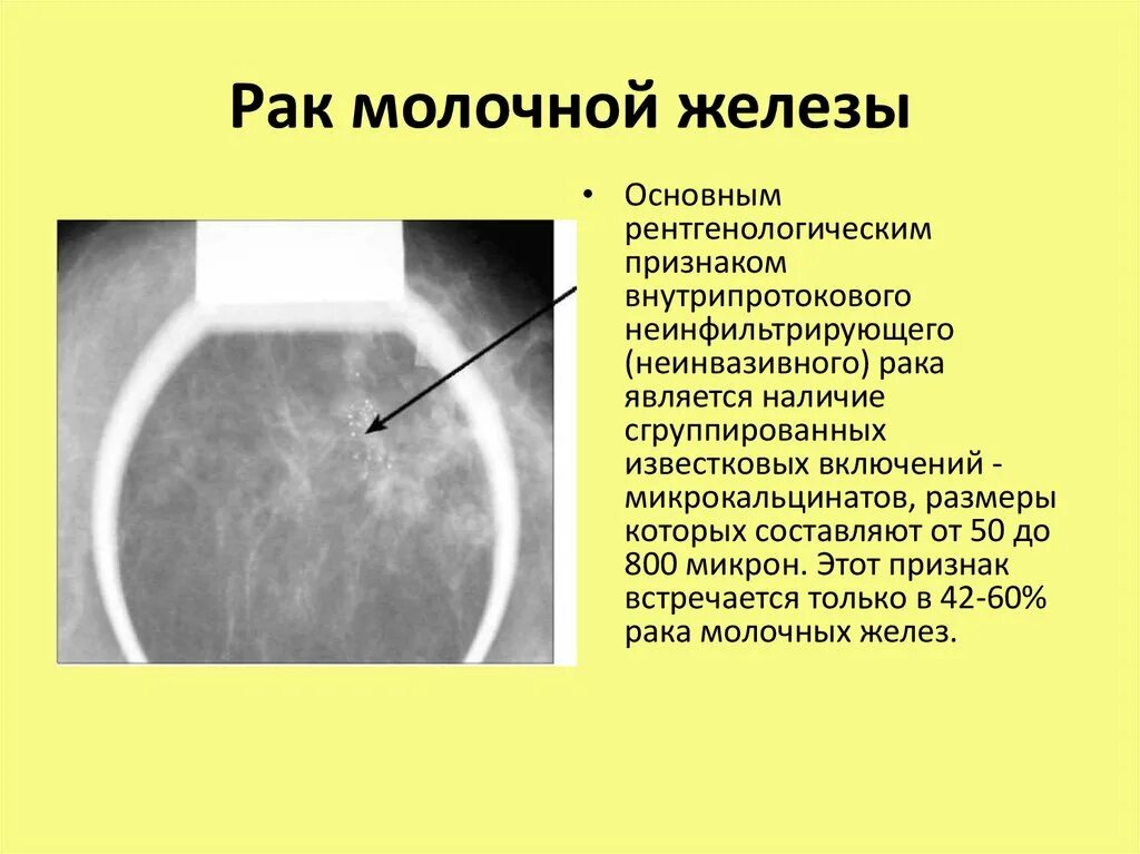 Плотный симптом