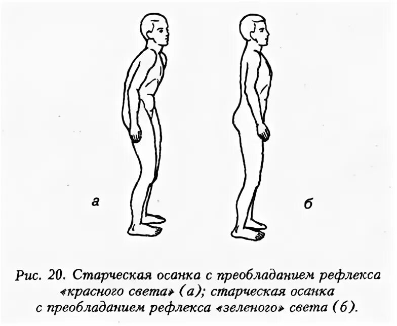 Зеленый рефлекс. Типы осанки человека. Рефлекс красного света. Типы осанки по штаффелю. Старческая осанка.