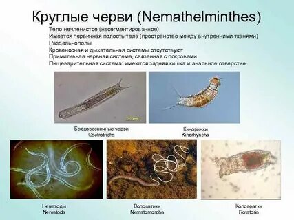 Членистый червь