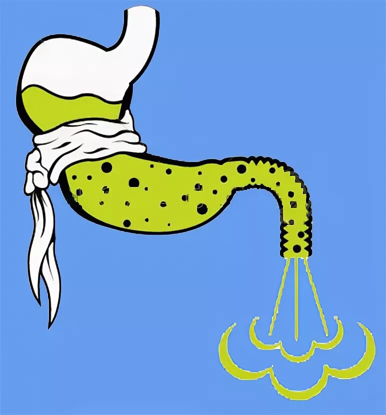 Вздуло кишечник. Вздуло кишечник
