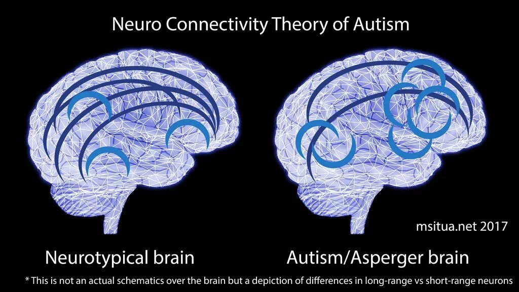 Brain vs brain. Мозг аутиста. Перегрузка мозга. Мозг аутиста и нормального человека. Схема мозга аутиста.