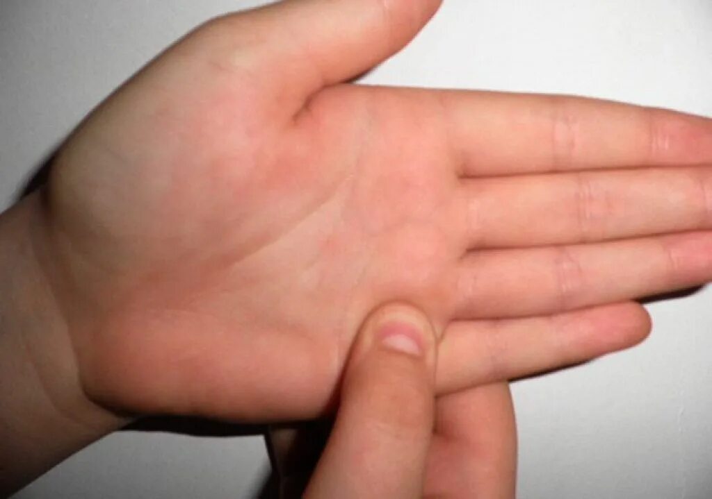 родинка на пальце на ладони. что такое гигрома запястья кисти. внутренняя сторона указательного пальца. шишка на ладони на пальце. что такое гигрома запястья кисти.