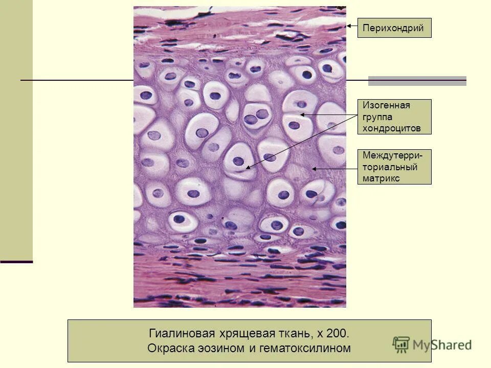 Изогенные группы. Изогенные группы гиалинового хряща. Гиалиновая хрящевая ткань гистология. Группа гиалинового хряща ткани. Матрикс хрящевой ткани.