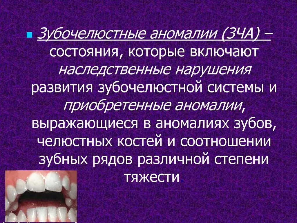 Факторы возникновения зубочелюстных аномалий. Аномалии зубочелюстной системы. Пороки зубочелюстной системы. Аномалии развития зубочелюстной системы. Аномалии зубно челюстной системы.