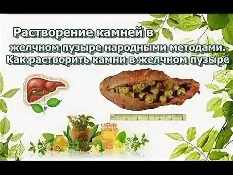 Растворение камней в желчном пузыре отзывы. Растворить камни в желчном пузыре. Растворение конкрементов в желчном пузыре. Желчные камни растворение. Растворение камней в желчном пузыре.