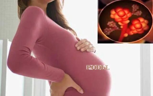 Беременность и сосудистые заболевания. Сосудистые изменения у беременных. Тромбофилия у беременных фото. Сосуды беременной женщин. Тромб во время беременности.