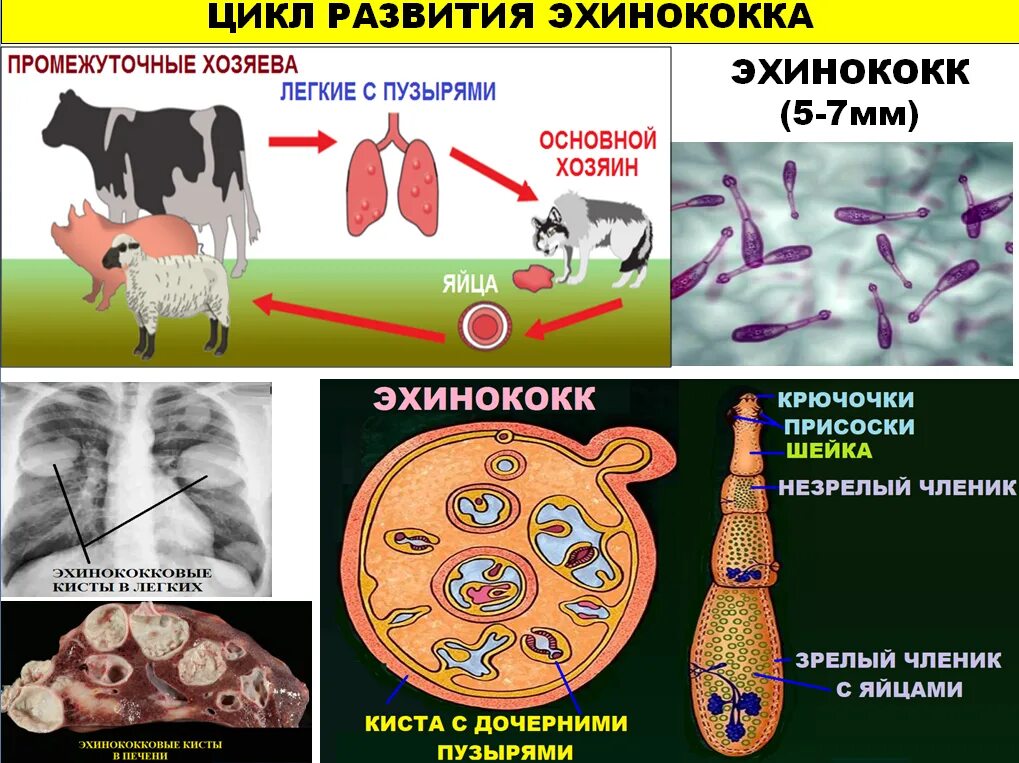 Для каких паразитов человек является промежуточным хозяином. Эхинококк жизненный цикл промежуточный хозяин. паразитические черви эхинококк. эхинококк человек промежуточный хозяин. личиночная стадия эхинококка.