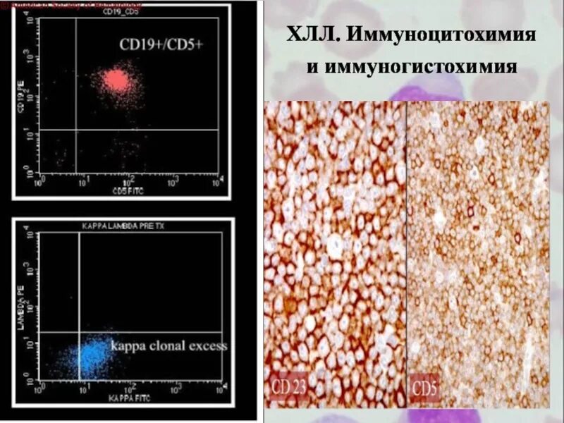 Иммуногистохимия. Иммуногистохимия лейкозов. Иммуногистохимия при лейкозах. Иммуногистохимия презентация.