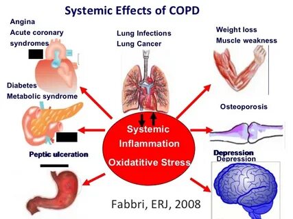Effect system