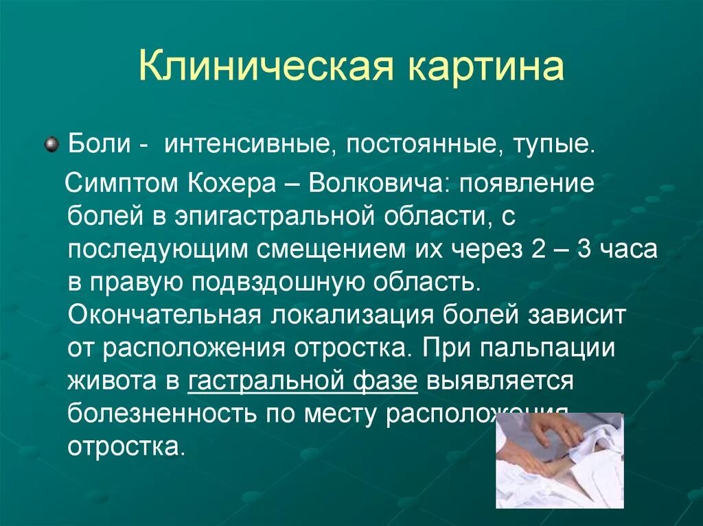 Кохер аппендицит. Симптом кохера-Волковича. Симптом кохера Волковича при аппендиците. Симптом кохера патогенез. Острый аппендицит симптом кохера Волковича.