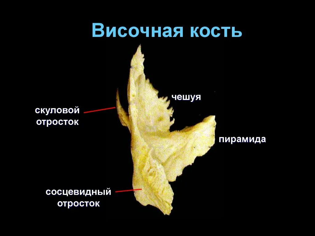 Пирамида височной кости анатомия. Височная кость анатомия строение. Пирамида (каменистая часть) височной кости. Височная кость топография. Изменения височной кости