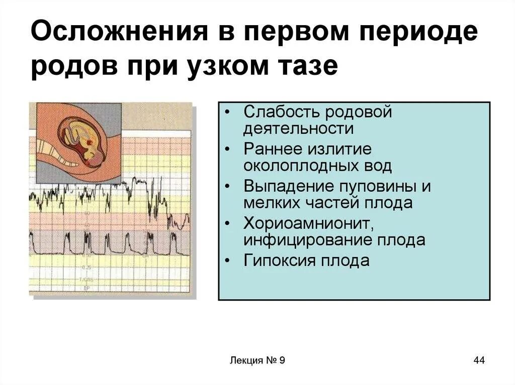 Безводный период норма. Осложнения первого периода родов. Осложнение при первом периоде родов. Осложнения при 1 периоде родов. Осложнений при узкий таз первый период родов.