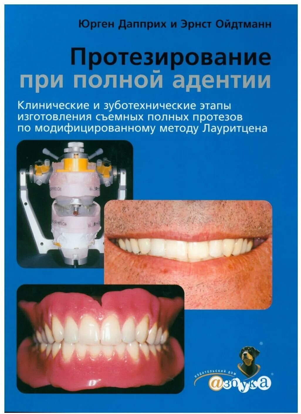 Армирование съемного протеза. Клинические этапы изготовления чспп. Клинико лабораторные этапы изготовления частичных съемных протезов. Лабораторные этапы изготовления протезов. Этапы изготовления частичного съемного протеза.