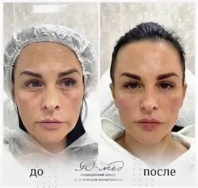 Фулл фейс что это. Фулл фейс что это