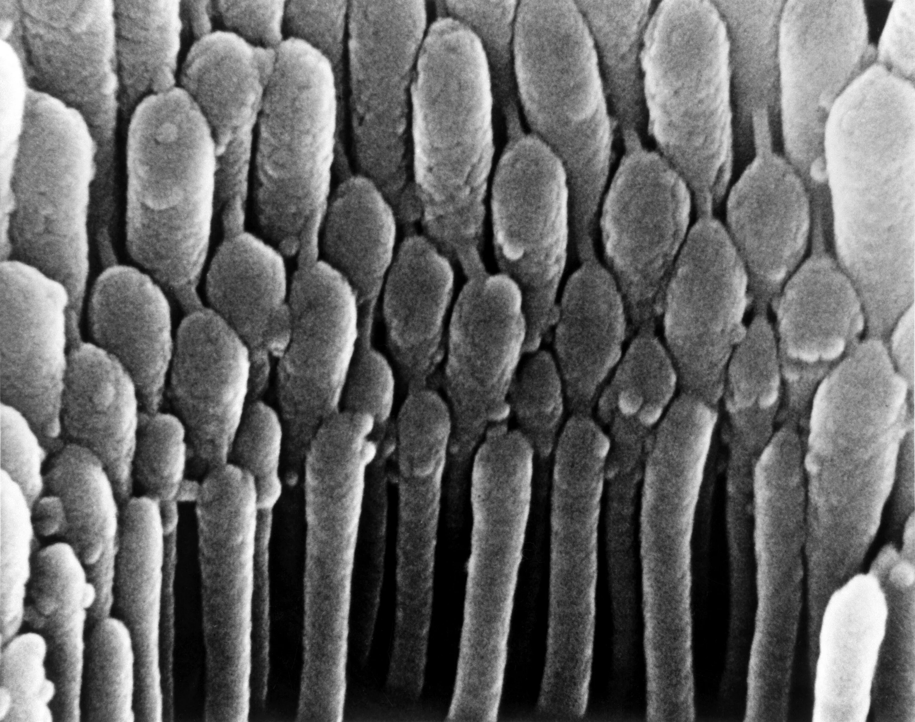 Волос под микроскопом. Клетки волоса под микроскопом. Волос под электронным микроскопом. Человеческий волос под микроскопом.