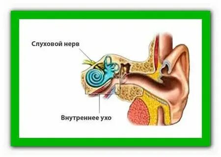 Чем лечить слуховой нерв