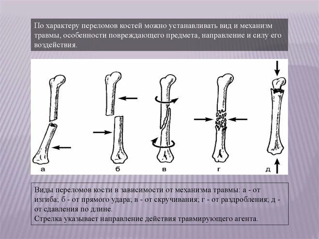 Перелом кости может быть каким. Классификация переломов по характеру повреждения кости.