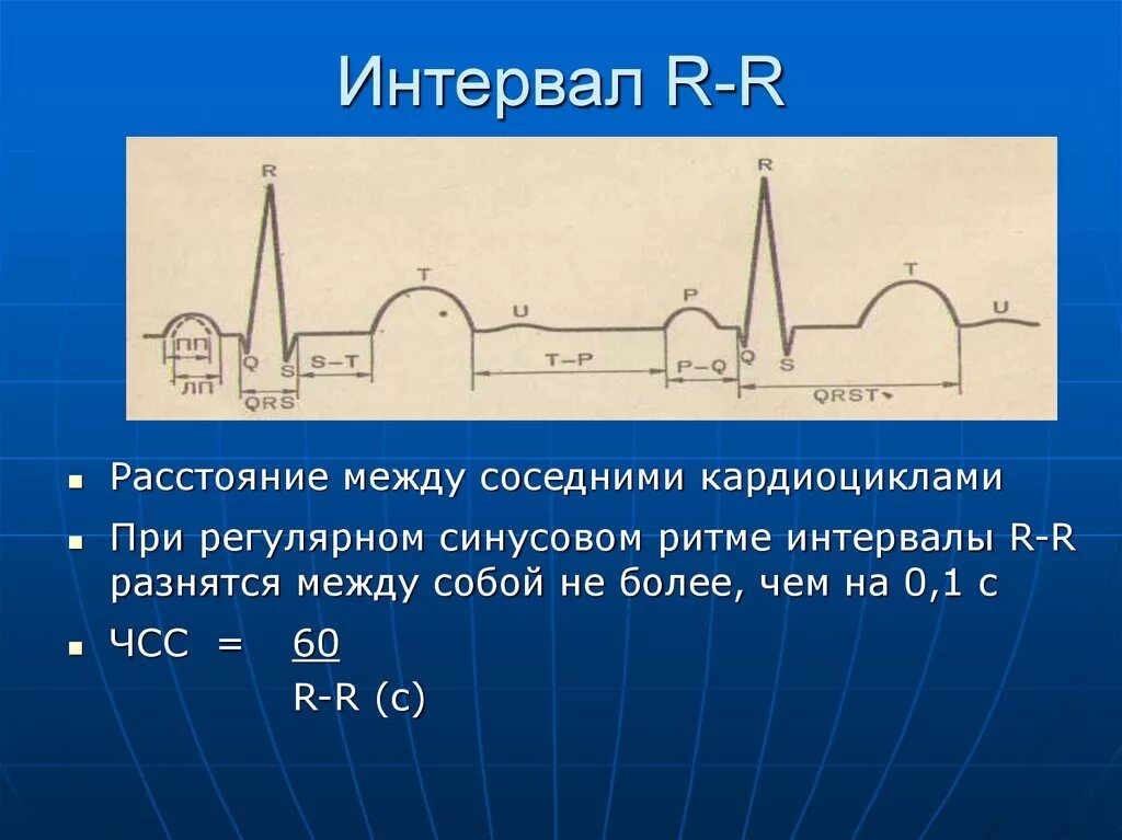 Аналитический интервал. Удлинение интервала RR на ЭКГ. R-R интервалы. Интервал r r в ЭКГ. Длительность интервала RR.