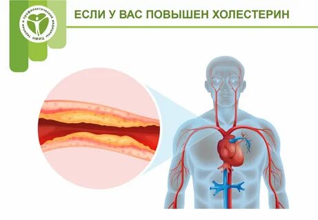 Какое значение холестерина считается опасным