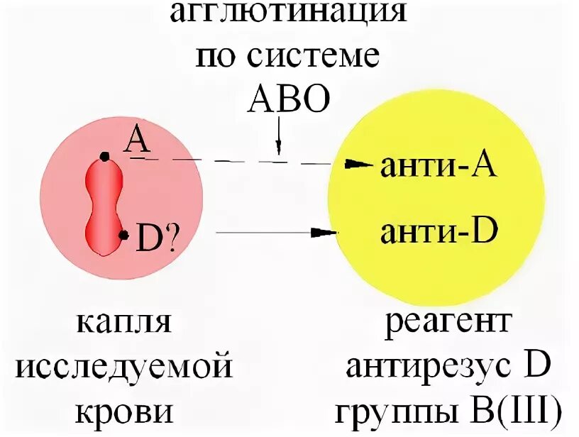 Внутриутробное переливание крови при резус конфликте. Переливание крови по резус фактору схема. Агглютинация группы крови 3 положительная.