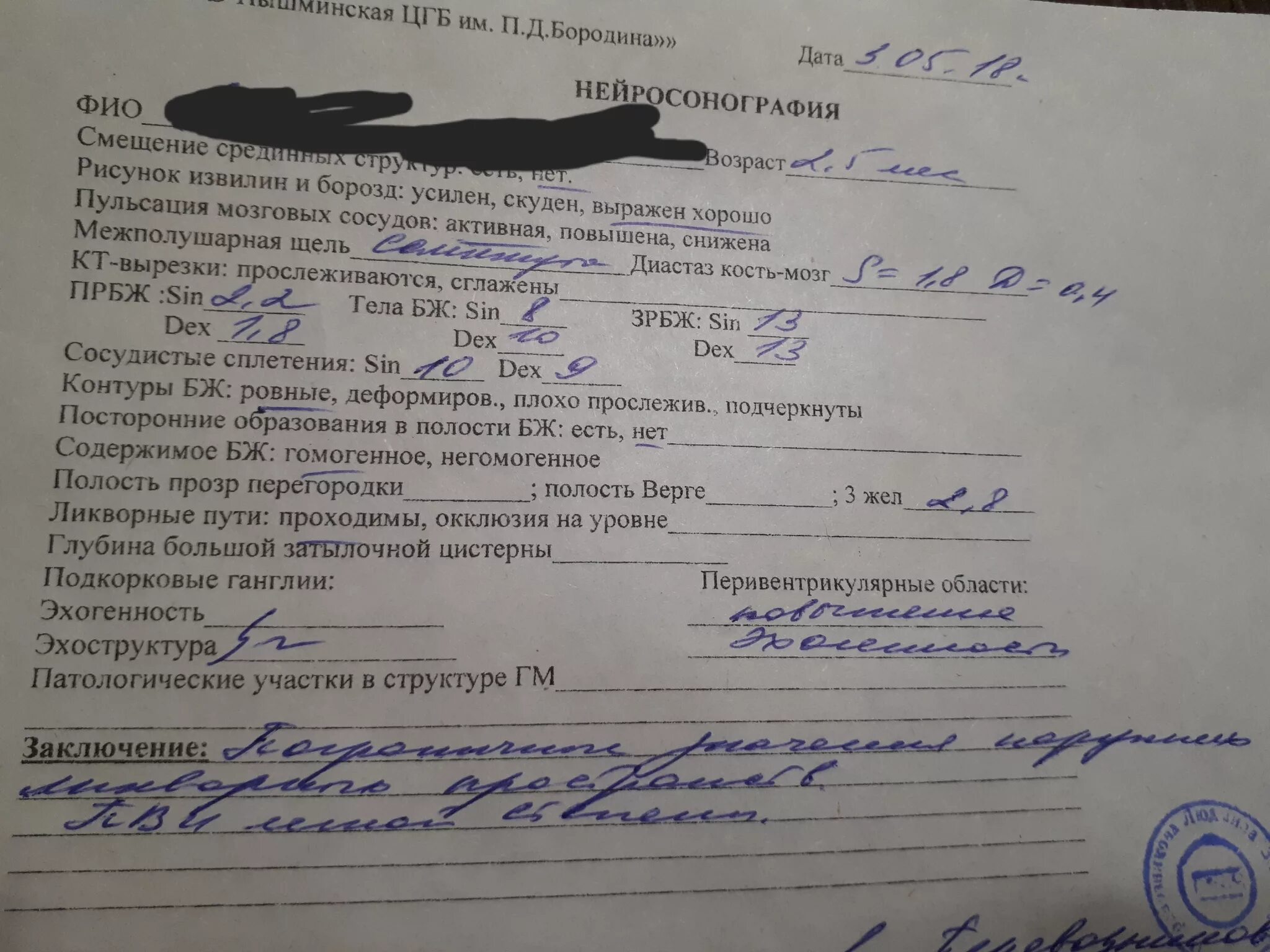 Внутричерепная липома. "фронтальный разрез полушарий большого мозга(уровень среднего мозга". Межполушарная щель головного мозга. Боковые желудочки нейросонография. Межполушарная щель головного мозга.