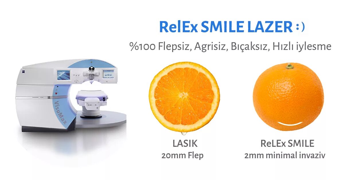 Лазерная коррекция RELEX smile. Smile технология лазерной коррекции зрения. Метод лазерной коррекции RELEX smile. Лазерная коррекция зрения методом Femto-LASIK. Коррекция smile clinicaspectr ru