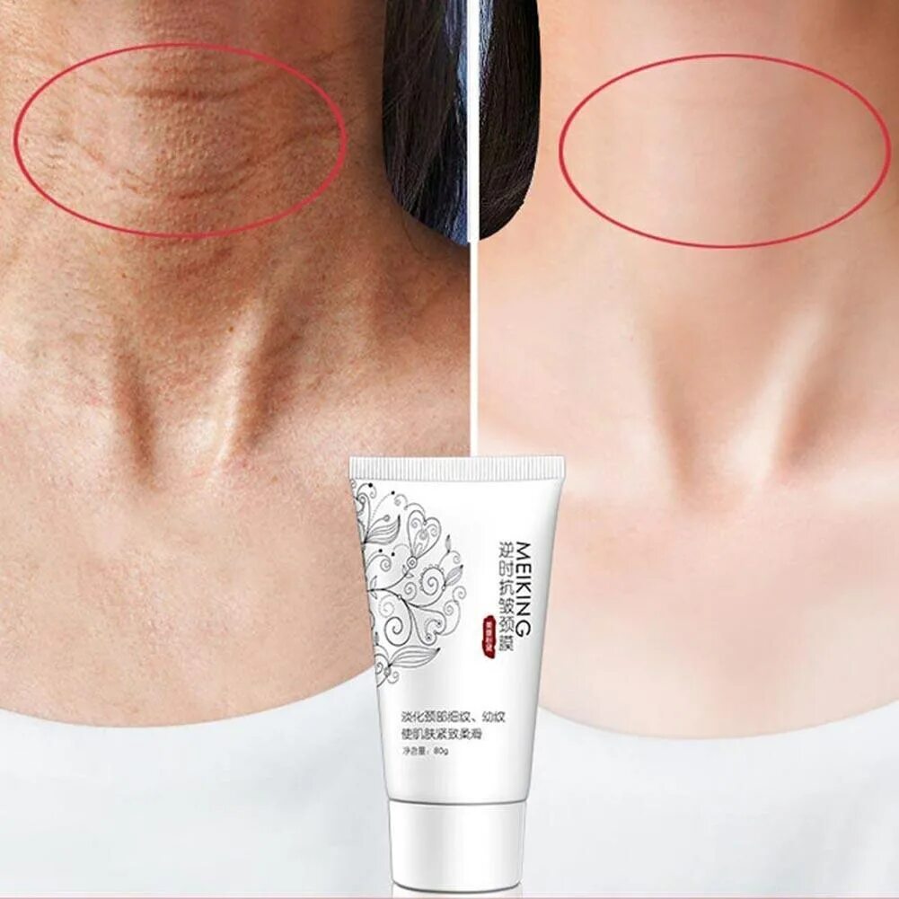 Крем для шеи. Как отбелить шею. Как отбелить шею. Корейский крем для шеи. Крема против морщин на шеи.