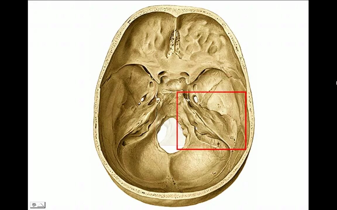 Sulcus sinus petrosi inferioris. Impressio trigeminalis на черепе. sulcus sinus sigmoidei parietal. сулькус синус петроси супериор.