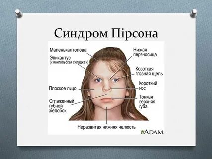 Губной желобок
