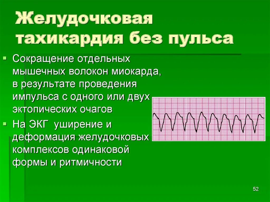 Сильное сердцебиение температура