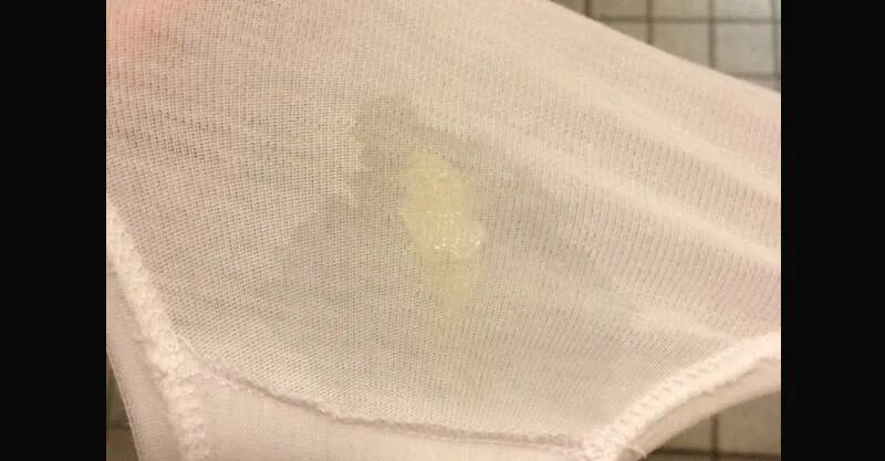 ультразвуковые критерии овуляции. выделения при овуляции. выделения ао днямцикла. выделения приовудяции. признаки овуляции у женщины выделения.