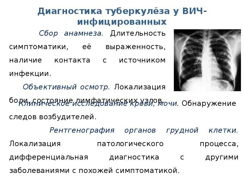 Вич инфекции гепатиты туберкулез. Туберкулез у больных ВИЧ-инфекцией. Туберкулез и ВИЧ инфекция. Туберкулез у ВИЧ инфицированных. Туберкулез на поздних стадиях ВИЧ.