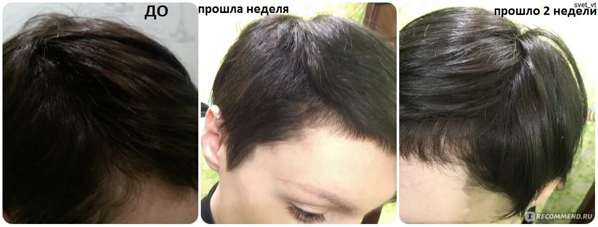 Мумие до и после волосы Маска для волос с аевитом и мумие 96 фото