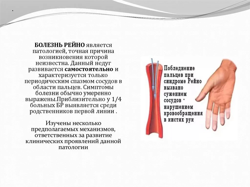 Синдром рейно это простыми словами. Синдром Рейно конечности. Клиническая картина синдрома Рейно. Основных клинических симптомов при синдроме Рейно.. Сосудистые препараты при синдроме Рейно.